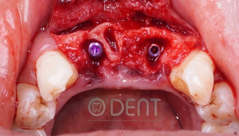 17187 odent clinica dental 768x438