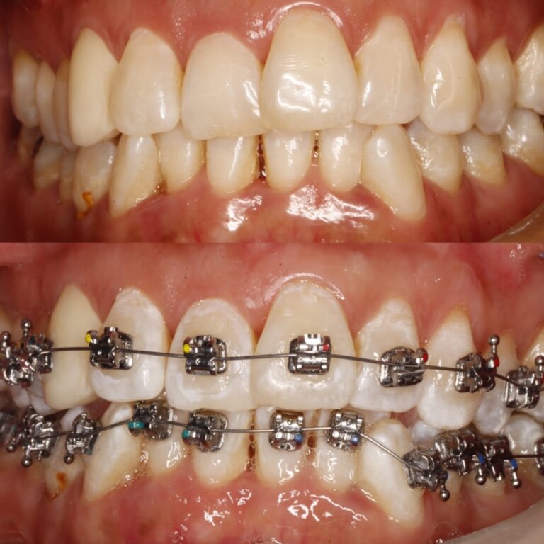 17439 dentalpro sjr 768x768