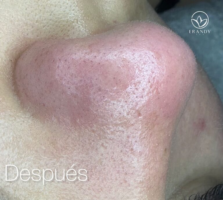 4343 erandy spa 768x690