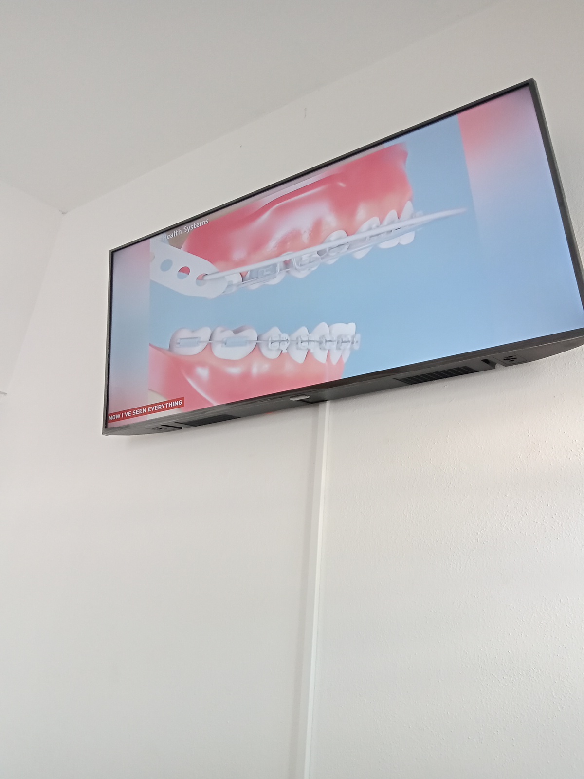 leetx-google-photo-73609-1