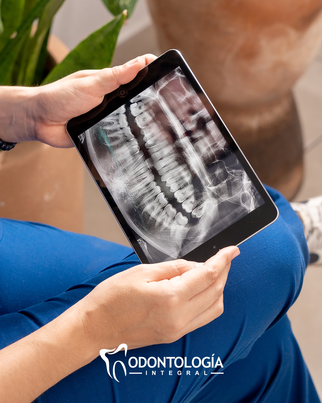 leetx-google-photo-74441-1