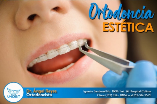 leetx-google-photo-74490-2 leetx-google-photo-74490-2