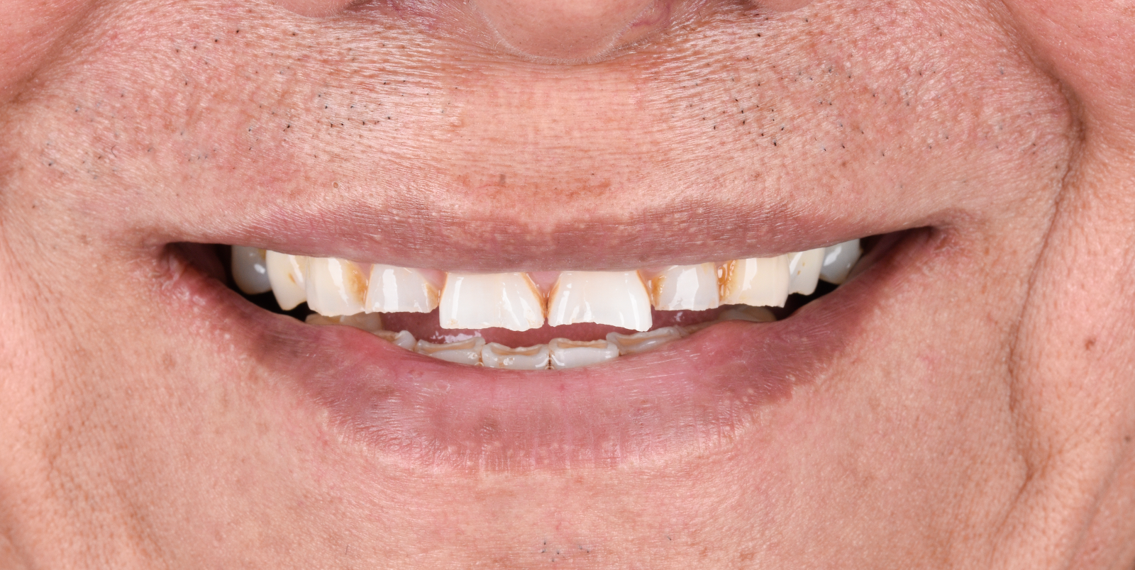 leetx-google-photo-74505-1