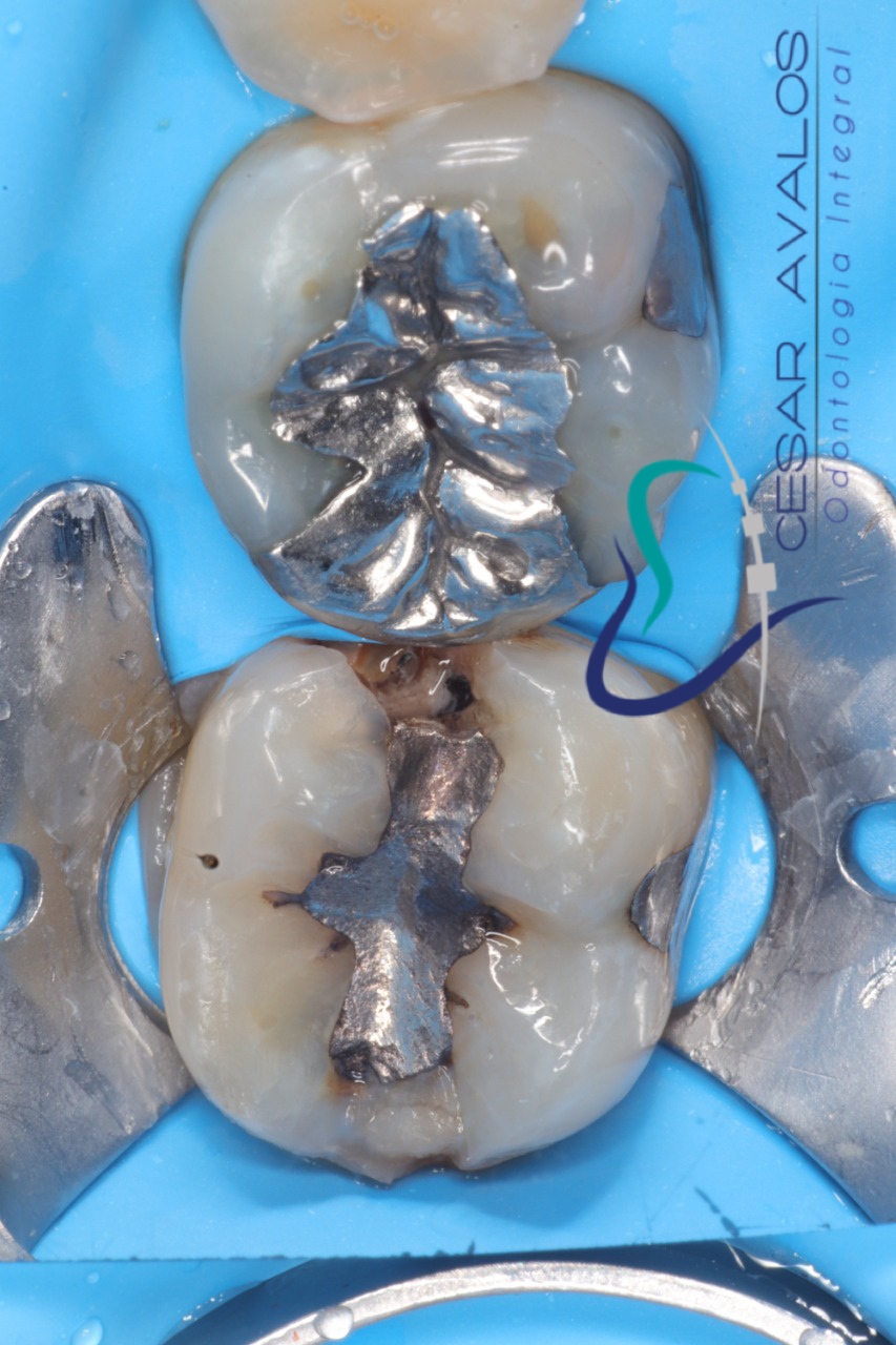 leetx-google-photo-74545-1