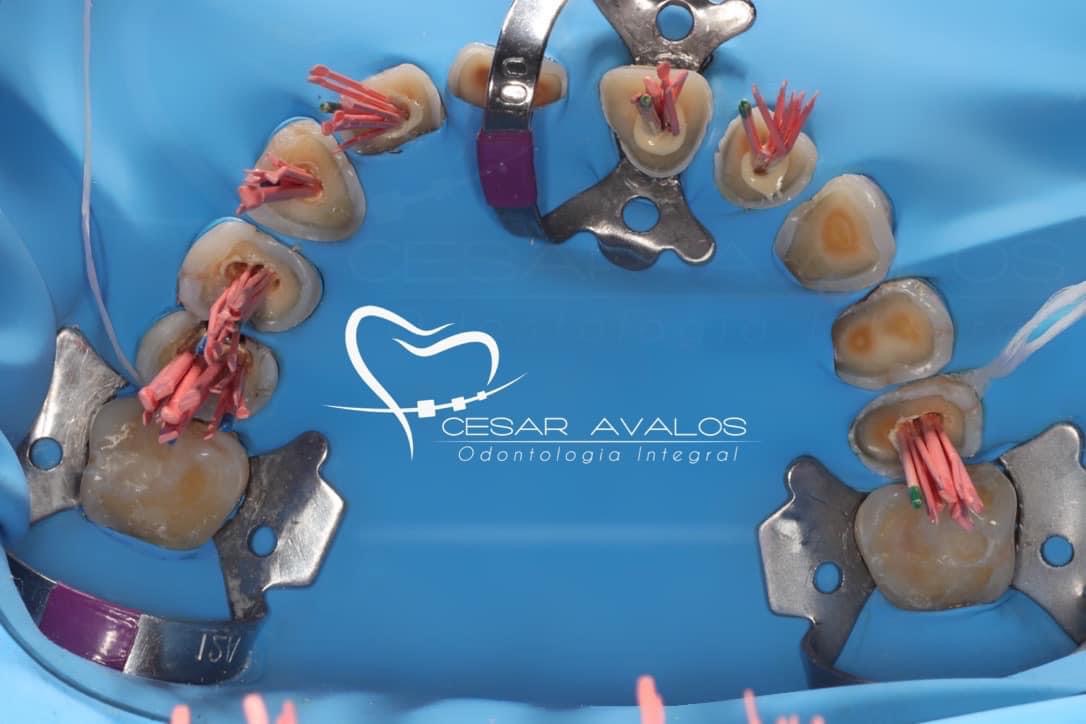 leetx-google-photo-74545-6 leetx-google-photo-74545-6