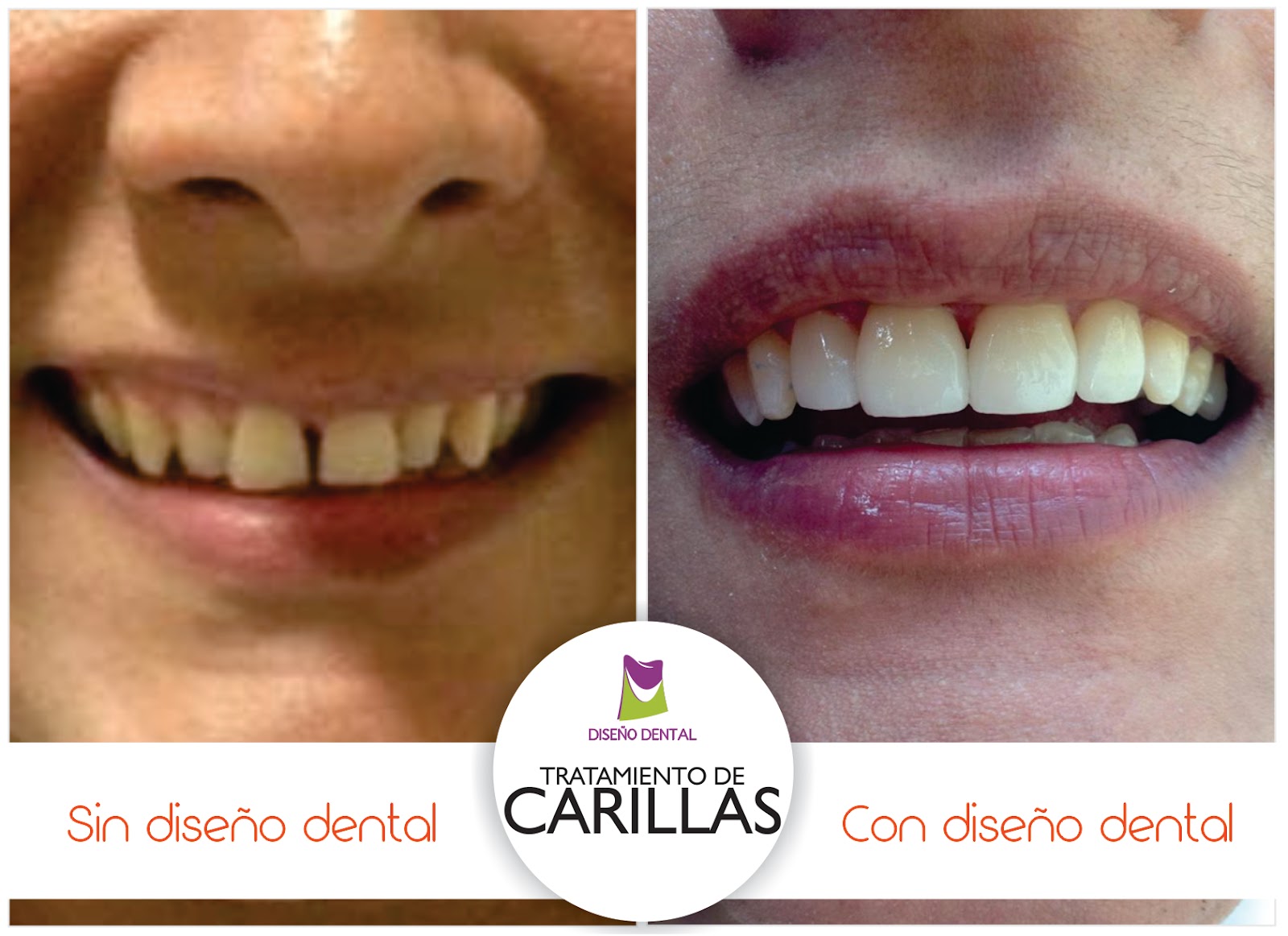 leetx-google-photo-74580-4 leetx-google-photo-74580-4